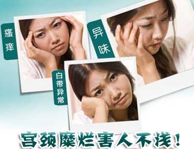 真假宫颈糜烂如何区分
